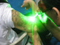 Nd yag laser untuk mesin penyingkiran tatu