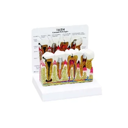 DARHMMY Medical Science Dental Pathology Models and Teaching Aids