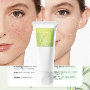 Natural Exfoliating Acne Oil-Free Men's Face Wash in Soft Tube