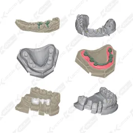 Dental 3D Scanner CAD CAM System White Light Scanners High-End Solution With 2 Cameras