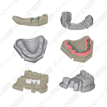 Dental 3D Scanner CAD CAM System White Light Scanners High-End Solution With 2 Cameras
