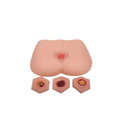 DARHMMY Medical Science Training Model for Decubitus Ulcer Care