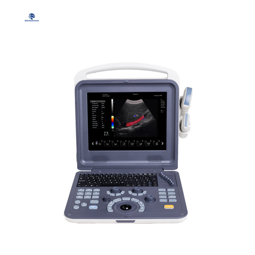 Color Doppler Ultrasound Scanner K2, High Quality Color Doppler ...