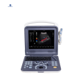 Color Doppler Ultrasonund Scanner K2