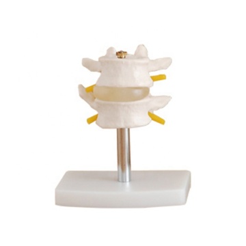 Three-Section Medical Model Anatomy Manikin for Lumbar Vertebrae Teaching