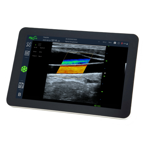 farm ultrasound machine