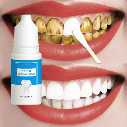 OMY LADY Teeth Whitening Essence: Best Selling Oral Hygiene Cleaning Serum in Europe