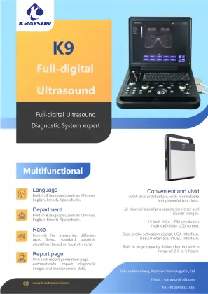Female liver cyst ultrasound diagnostic instrument