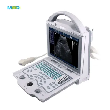 Black and White Ultrasound, Compact, Professional, and B Mode Ultrasound Scanner