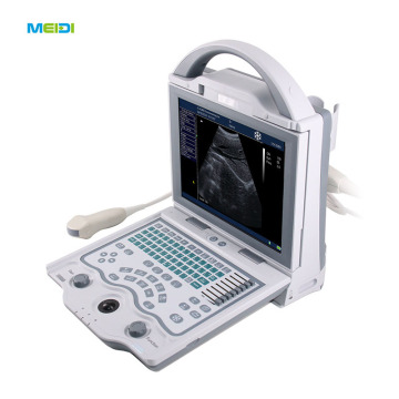 Black and White Ultrasound, Compact, Professional, and B Mode Ultrasound Scanner