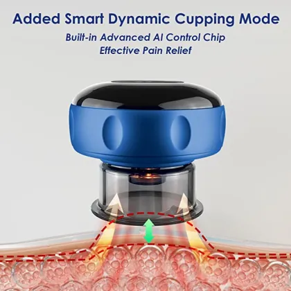 Smart Dynamic Cupping Therapy Set: 3-Level Electric Cupping Massager Machine
