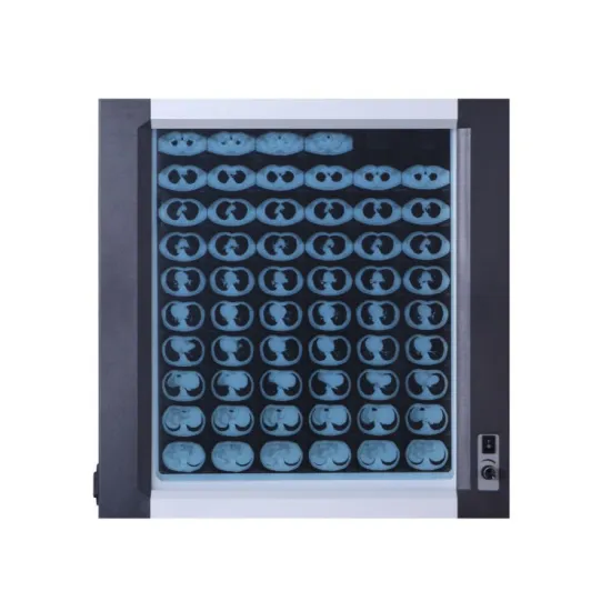 Professional Medical Led Film Viewer X-Ray View Box