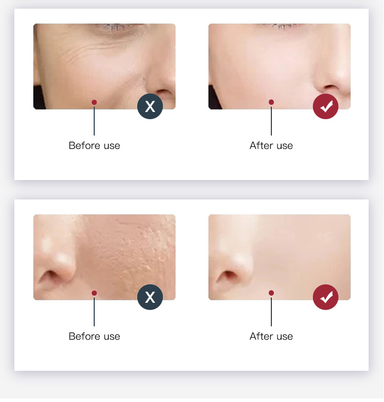 red light for skin therapy