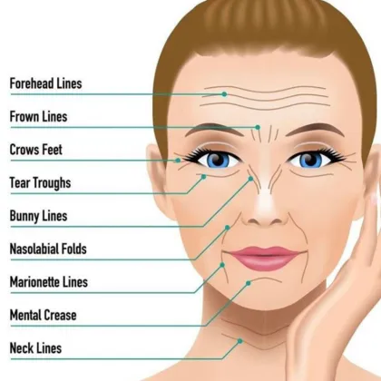 Reborn PLLA Biostimulator Face Rejuvenation Products