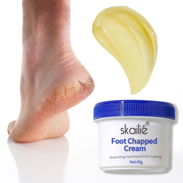 Skailie Private Label Organic Wholesale Foot Cream - Smooth, Moisturizing, Hydrating & Repairing