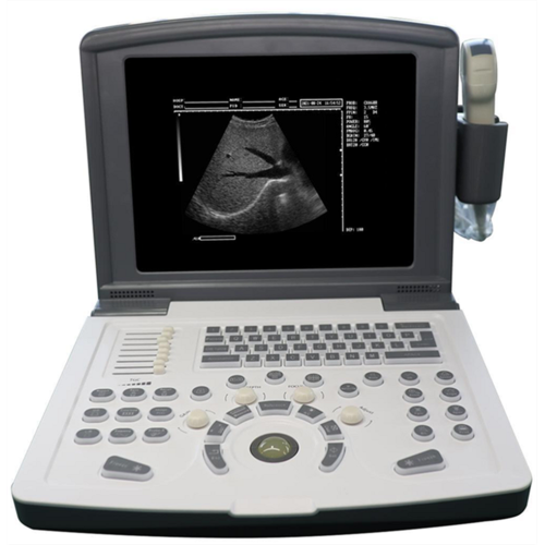 white and black full digital laptop ultrasound scanner