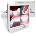 Cámara intraoral oral intraoral dental wifi intraoral