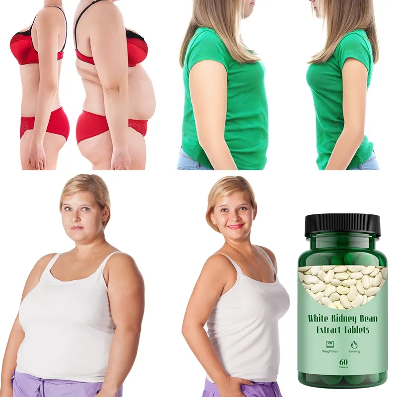 OEM/ODM Organic Vegan Weight Loss Tablets White Kidney Bean Extract Fast Fat Burning White Kidney Bean Slimming Tablets