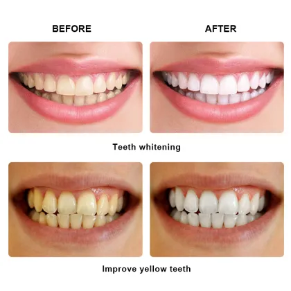 Private Logo Teeth Whitening Pen for Cleaning and Whitening Teeth
