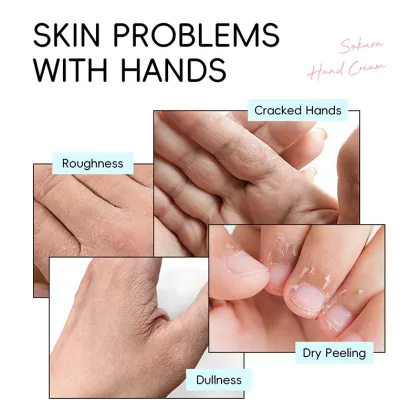 LAIKOU 30g Hand Cream - Smooth Skin, Moisturizing, Refreshing, Radiant, Japan Sakura