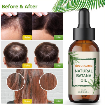 Batana Pure Batana Oil com forte óleos hidratantes de rebrota de cabelo