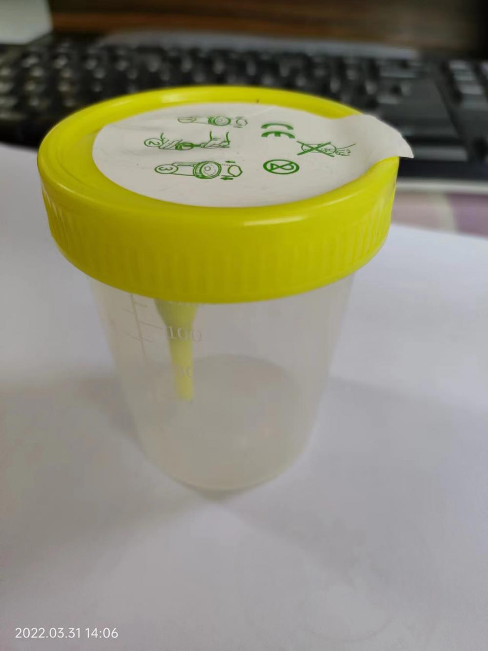 120ml Urine Specimen Container Urine Cup