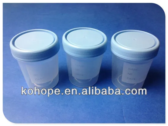 urine container with label