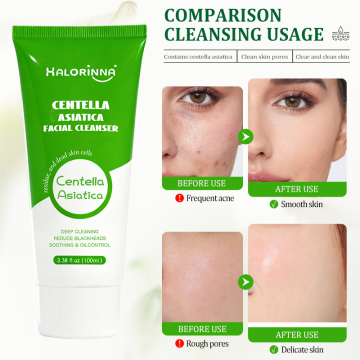 Leite de limpeza calmante Centella Asiatica para lavar o rosto