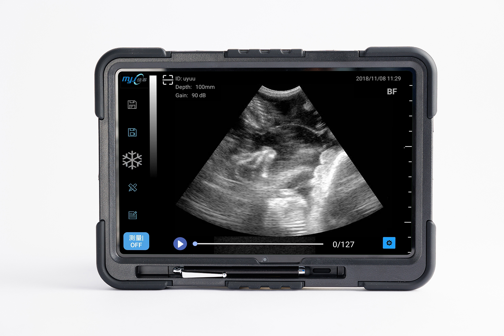 wireless ultrasound scanner