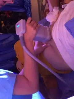 Choicy Professional ultrasound slimming beauty machine