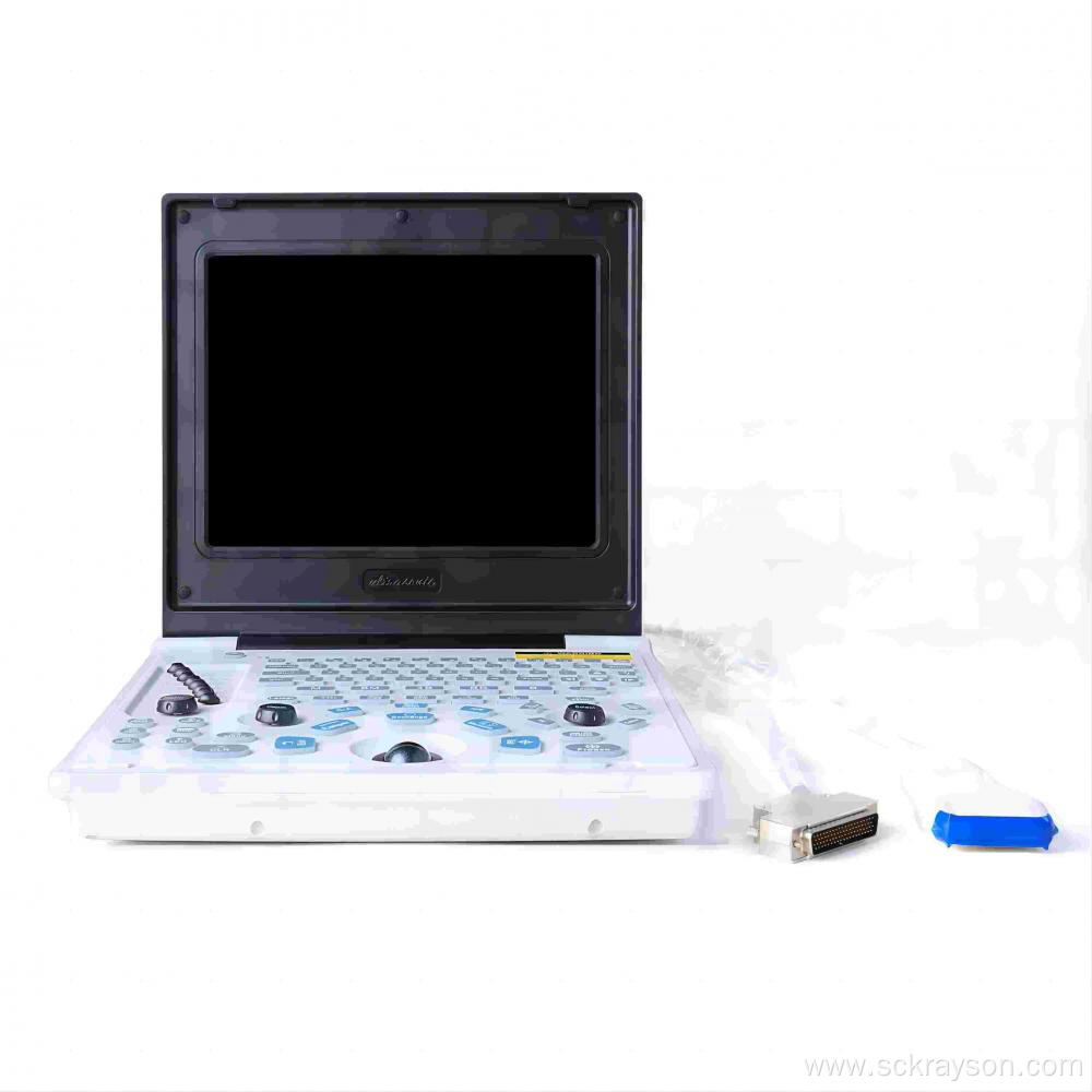 Female splenic thrombus ultrasound diagnostic instrument