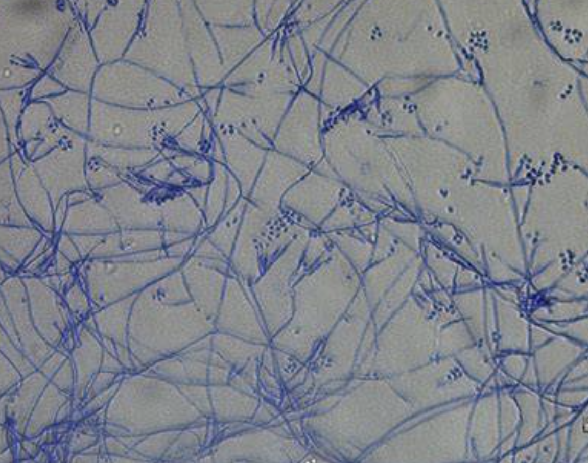 Biological Nematode Control Fungus