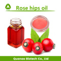 Rose Hip Extract Powder 10:1 Natural Oxidants