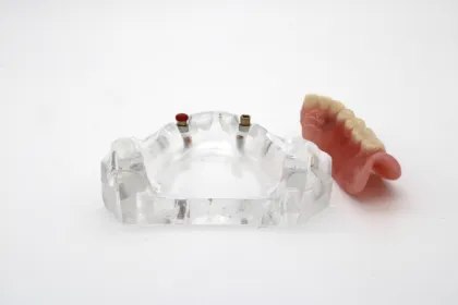 Dental Implant Model Overdenture Restoration Dental Teeth Model Factory Shop On Sale High Quality