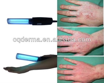 skin psoriasis scalp psoriasis treatment