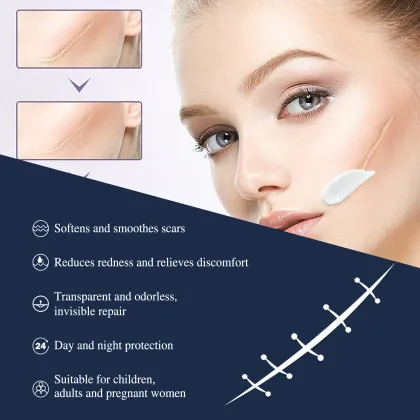 After Pregnancy Acne and Stretch Marks Repair Cream