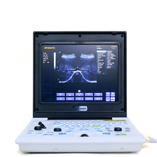 Male pancreatitis ultrasound diagnostic instrument