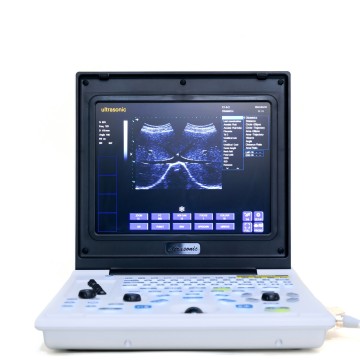 Мужчынскі панкрэатыт ультрагукавы дыягнастычны інструмент