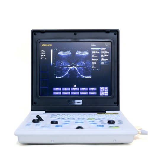 Мужчынскі панкрэатыт ультрагукавы дыягнастычны інструмент