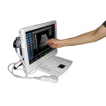 UTouch-8 Touch Screen 3D LCD Ultrasound Scanner