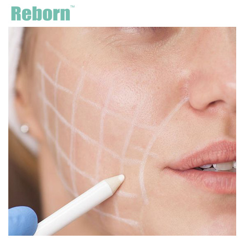 Face rejuvenation PLLA dermal fillers