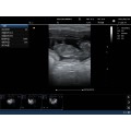 Партатыўны партатыўны ультрагукавой сканер KPC-5C Convex Color Doppler
