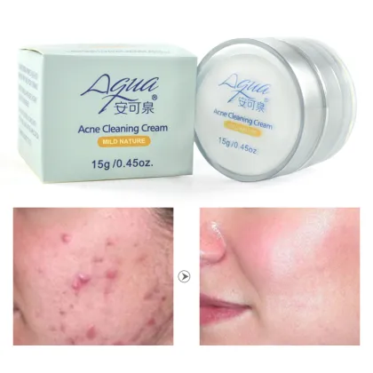 Wholesale Skin Whitening Face Cleanser with Acne Removal Cream and Oil Control