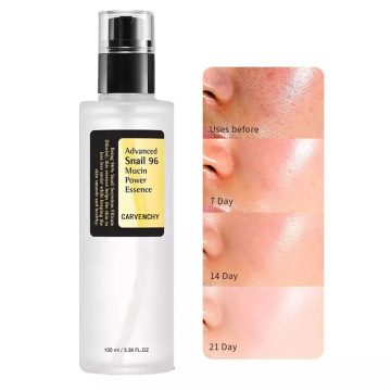 Lacin Siput Korea 96% Perbaikan Daya Esensi Hydrating Serum