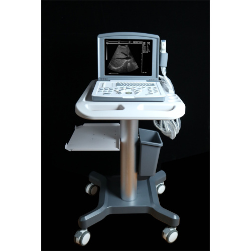 Laptop Ultrasound Machine Portable Black And White Ultrasound Scanner for Obstetrics Manufactory