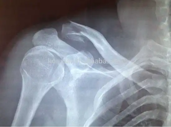 KND-A xray blue dry film AGFA DT2B film 14*17inch