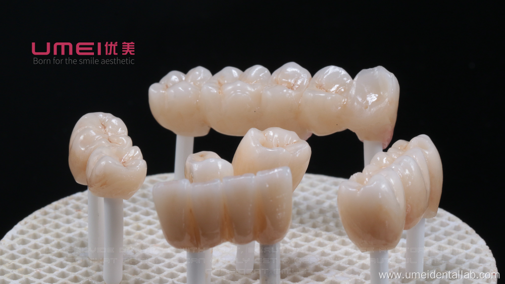 Zirconia bridge