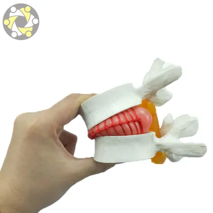 Vertebral Spine Simulator for Lumbar Disc Herniation Medical Science Model