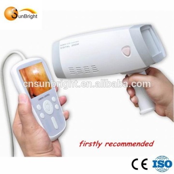 Hot selling cheap gynecology colposcope