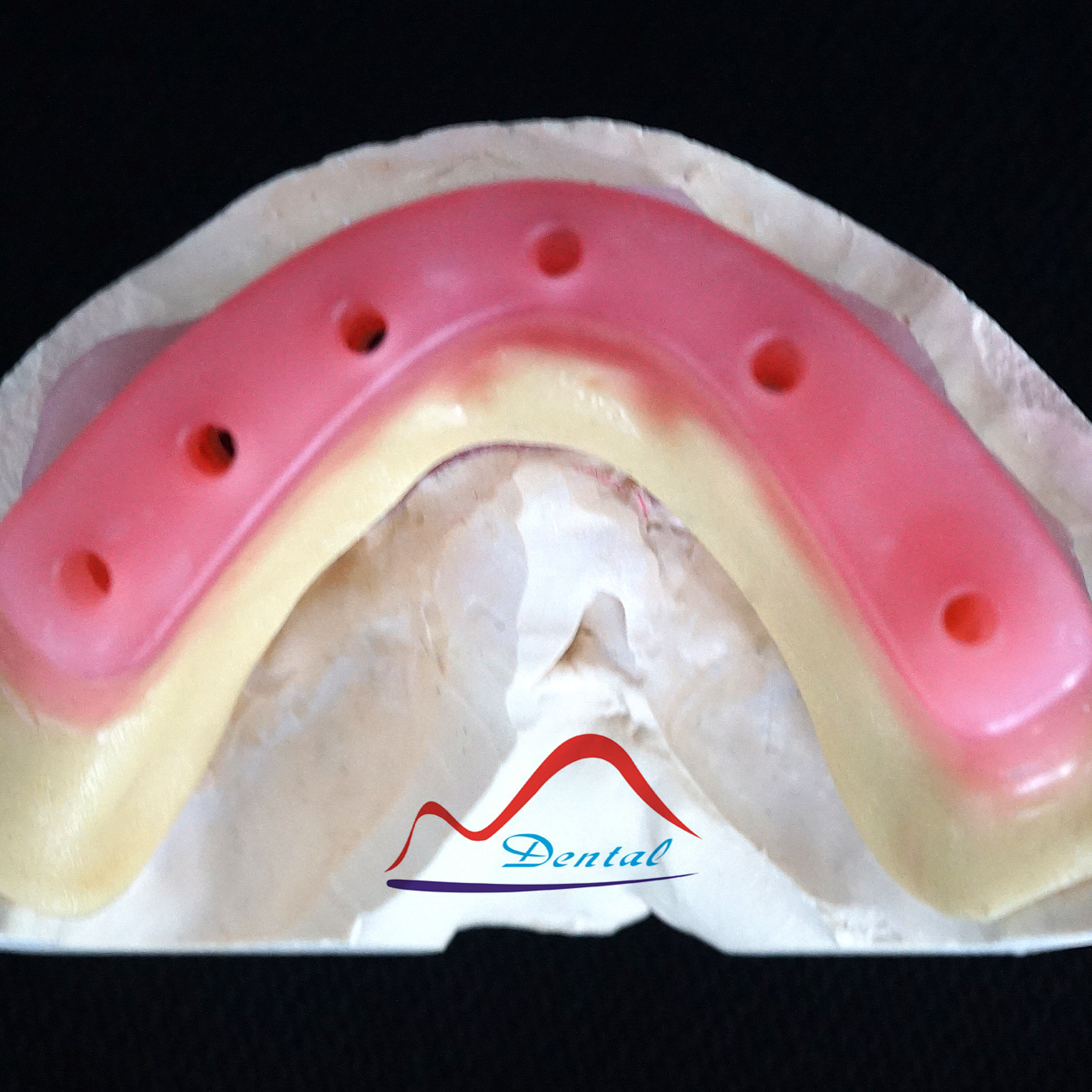 Implant Wax Rim